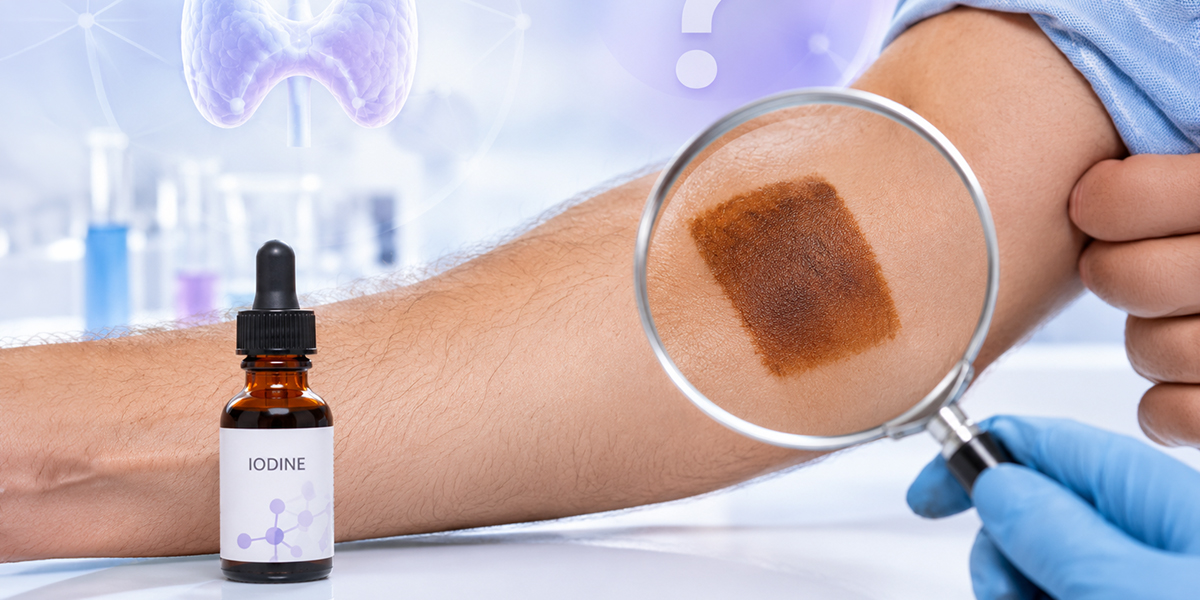 Iodine Patch” Test on the Skin: Is It Accurate for Detecting Deficiency?